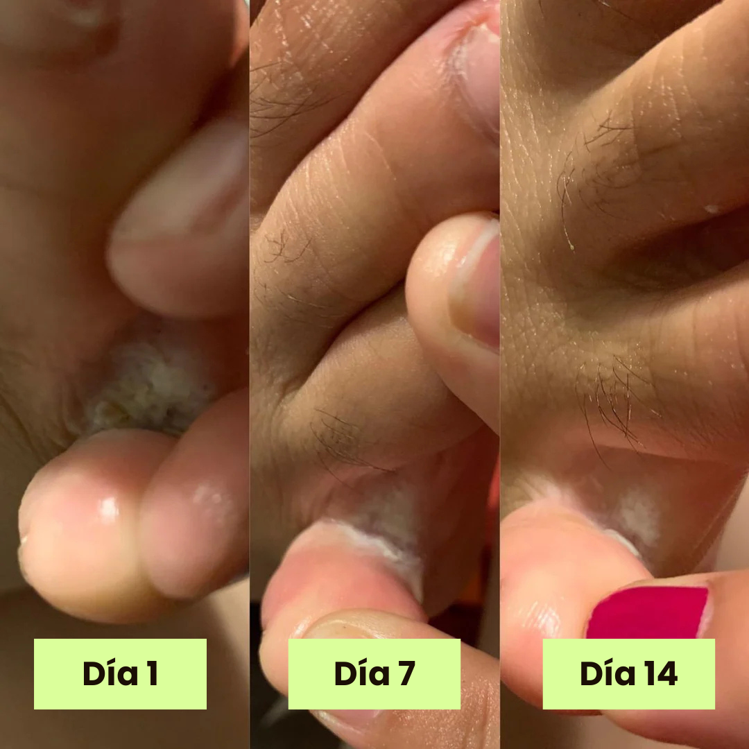 Floriva Soap | Jabón Anti-Hongos 100% Natural